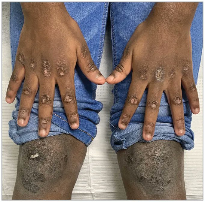 Dr. John Cush on Twitter: