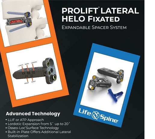 MedTechNow_'s tweet photo. #PatientCases 

~@csi360 announces 1st in-human experience with peripheral everolimus #DrugCoatedBalloon

~#Corelink announces first of its kind #Fusation™ #3DPrinted #Cervical anchor

~@Life_Spine announces 1st #surgical case 
#PROLIFT® LATERAL HELO FIXATED https://t.co/QQM0C4daJP