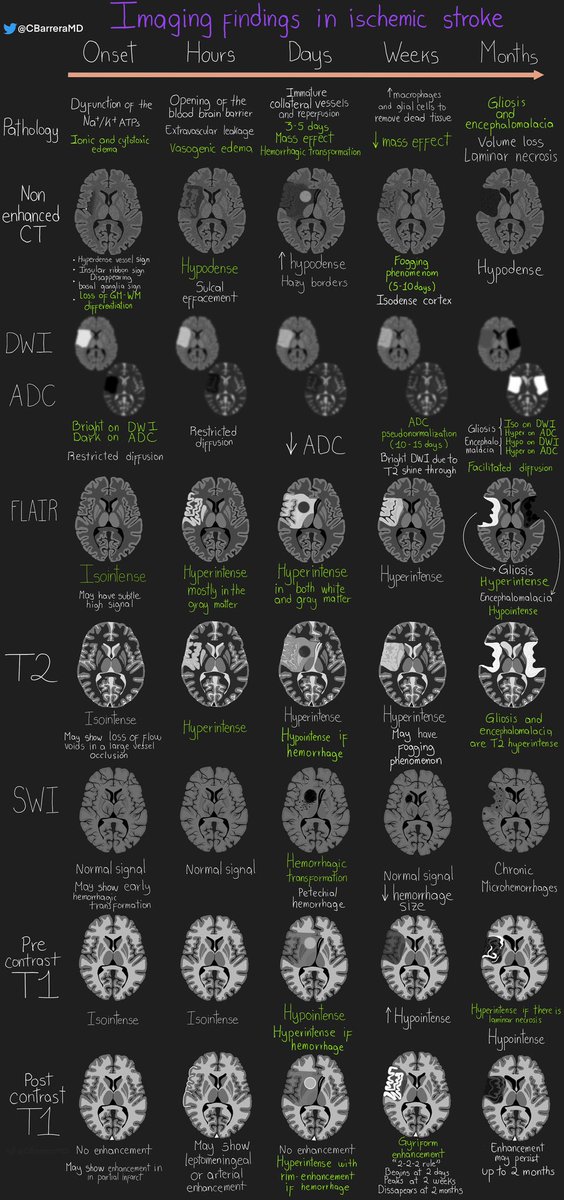Christian Barrera, MD (@cbarreramd) on Twitter photo Imaging findings in ischemic stroke 🧠
This is a more pragmatic approach. There are several classifications in the literature, but most of them follow this sequence of events
Thanks to <a href="/francisdeng/">Francis Deng, MD</a> for his feedback!
#radres #radiology #MedTwitter #FOAMrad #Neurology #Neurorad Imaging findings in ischemic stroke 🧠
This is a more pragmatic approach. There are several classifications in the literature, but most of them follow this sequence of events
Thanks to <a href="/francisdeng/">Francis Deng, MD</a> for his feedback!
#radres #radiology #MedTwitter #FOAMrad #Neurology #Neurorad