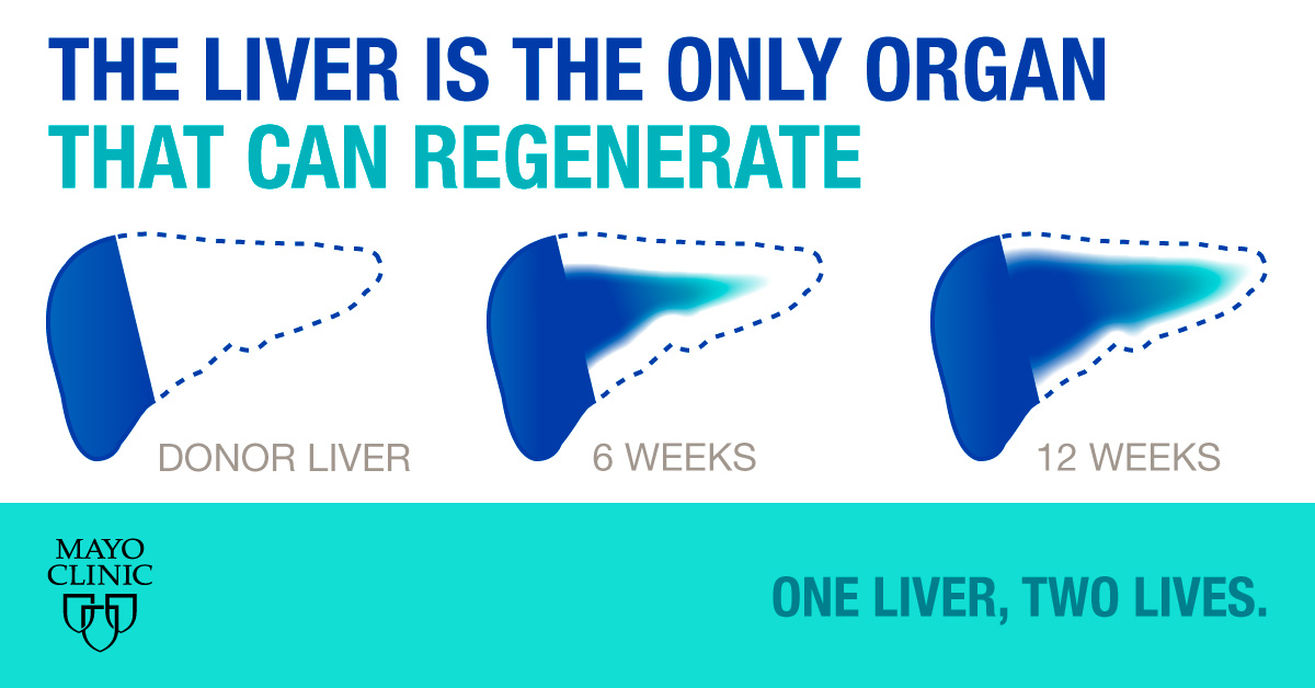 #MayoClinic has expanded the possibilities for patients needing a #livertransplant with our nondirected and #paireddonation programs. Learn more. mayocl.in/3I0SCOC