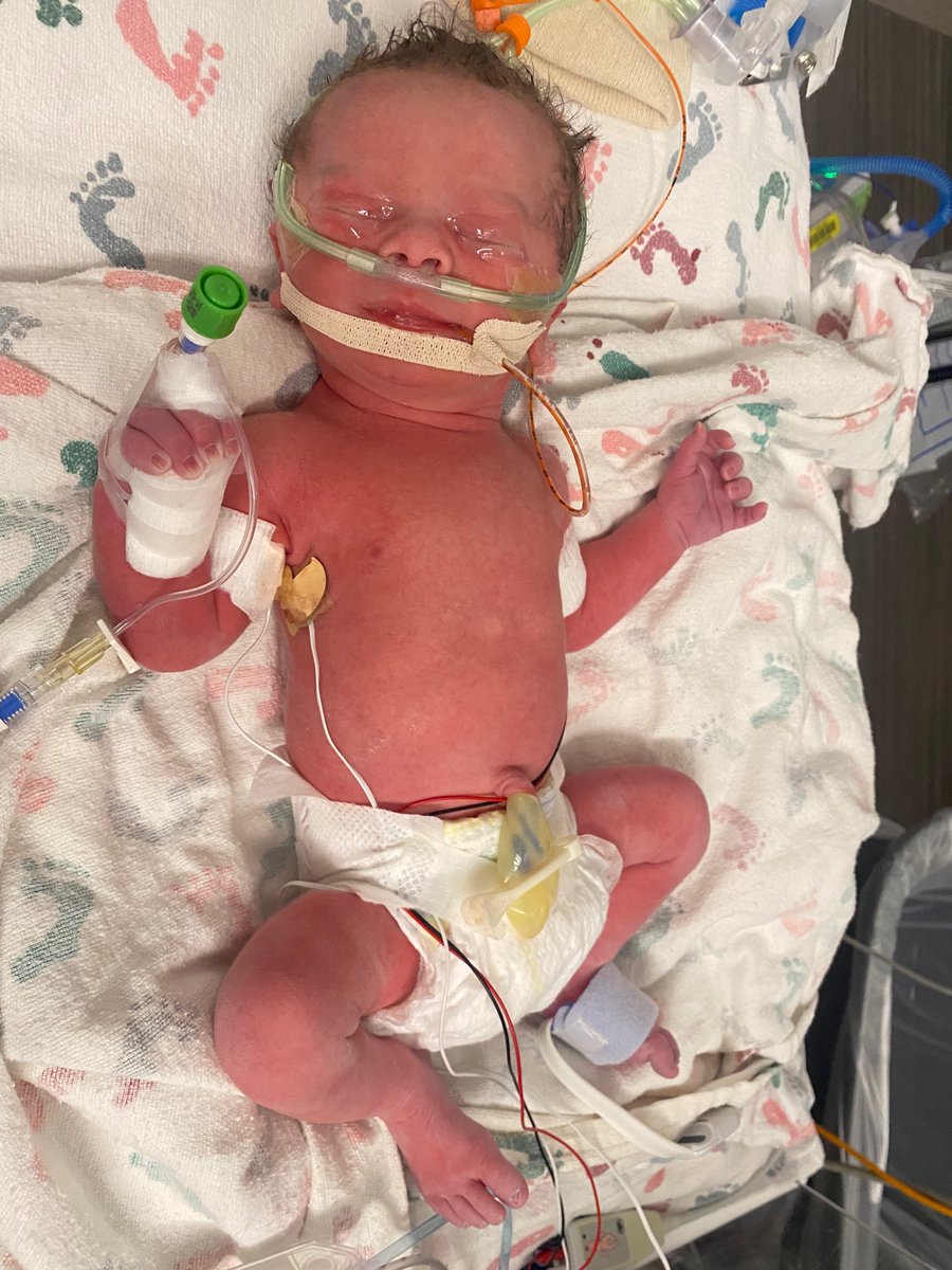 bronsonrory's tweet photo. @ohthatsNajee22 
New Steelers fan was born 6 weeks early 3/8/22 at 11:52pm he was 8 min away from sharing your B-DAY praying he stays strong.
#steelerstrong
#HereWeGo
 #SteelersNation https://t.co/cBHSgNhOF0