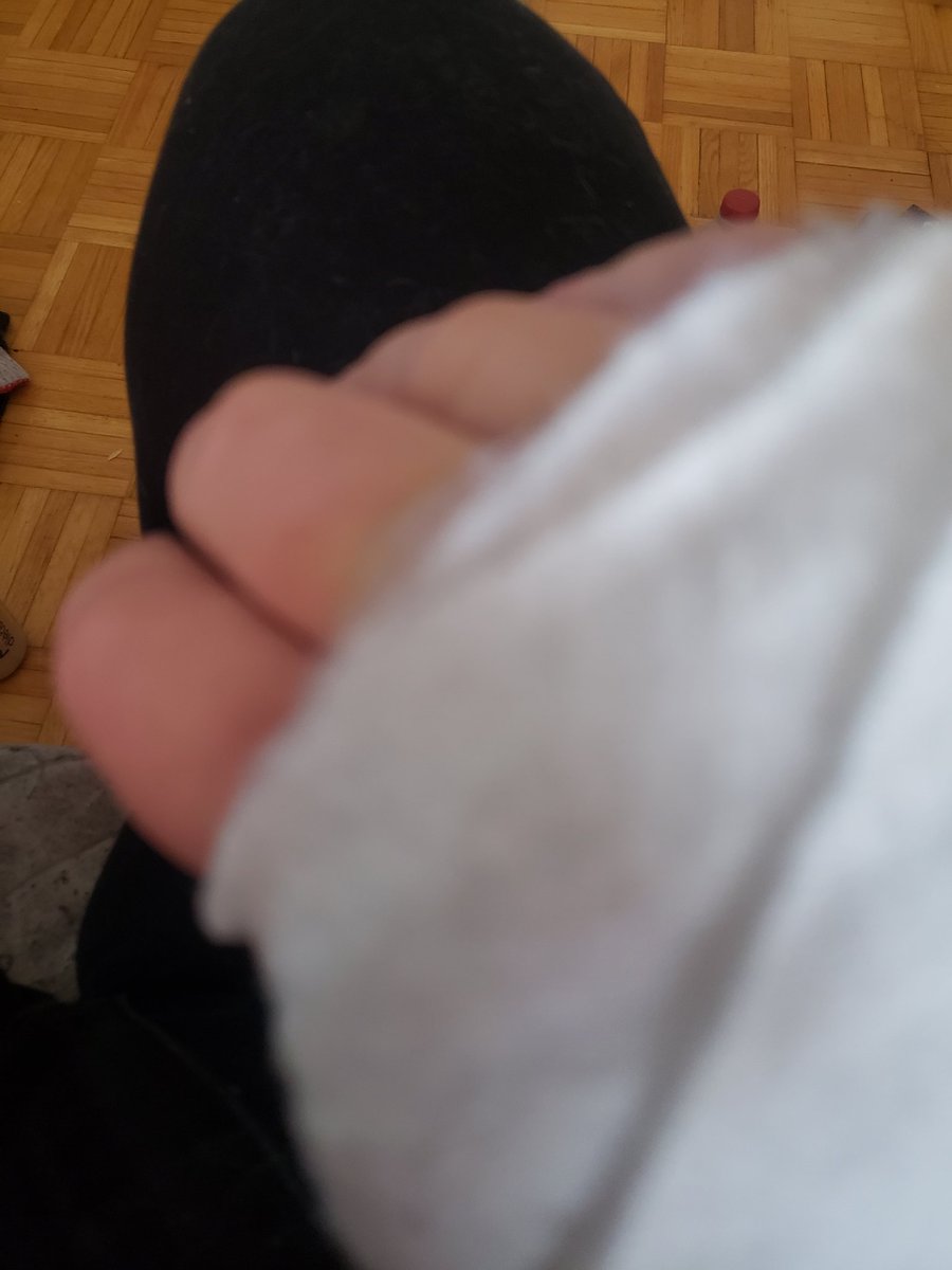 At Home 🏡 With A Broken 💔 Wrist It Happened On Friday In So Much Pain Its NUTS