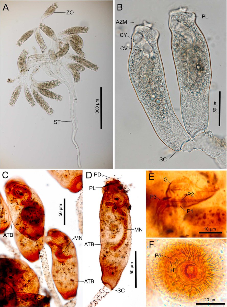 First Japanese Record of Epistylis wuhanensis (Ciliophora: Epistylididae) Attached to Lernaea cyprinacea (Copepoda), with a List of Epistylis Species Attached to Metazoans in Japan
#Newrecord #Epibionts #SpeciesDiversity
🔓doi.org/10.12782/specd…
