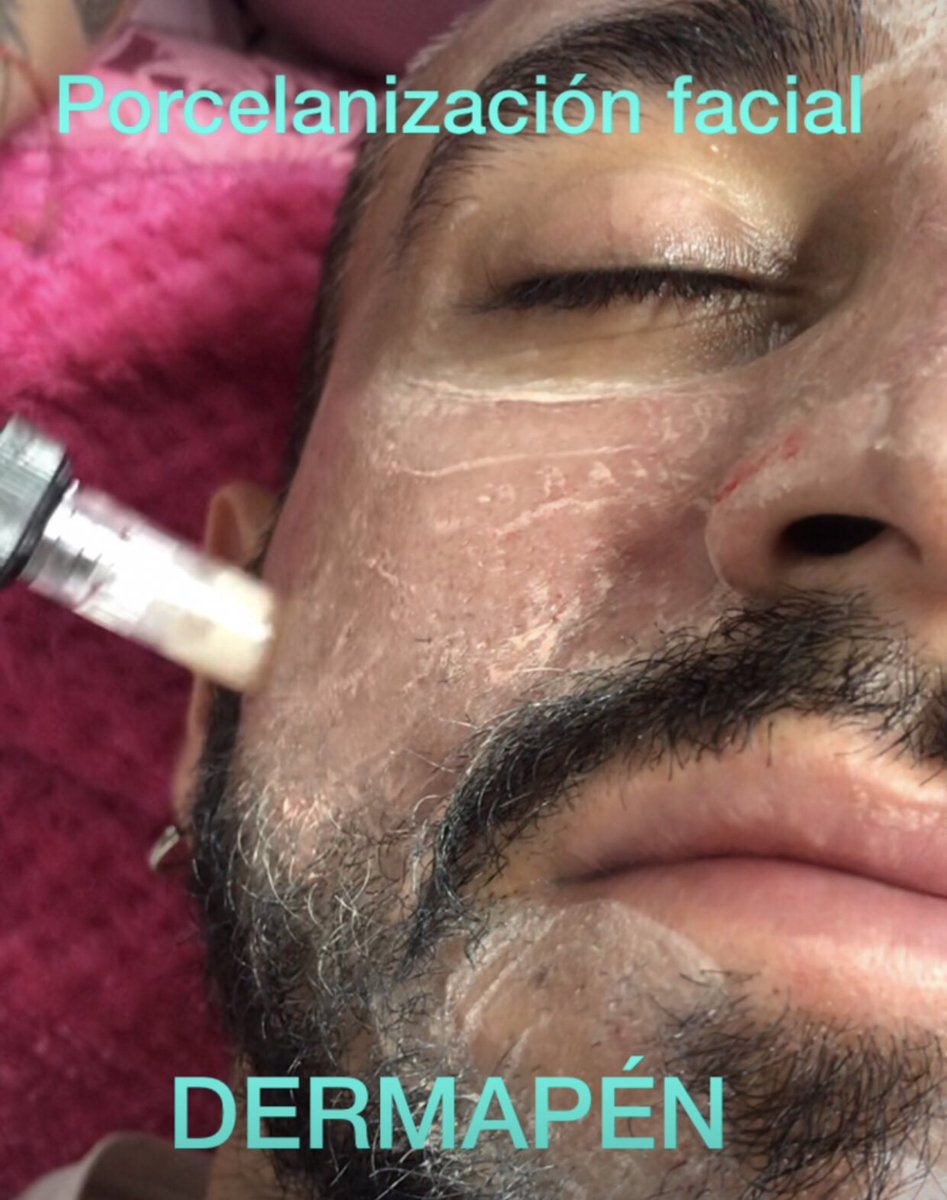 med_barber's tweet photo. #porcelanizacionfacial #spamens #medellingay https://t.co/7ufKWKQiX5