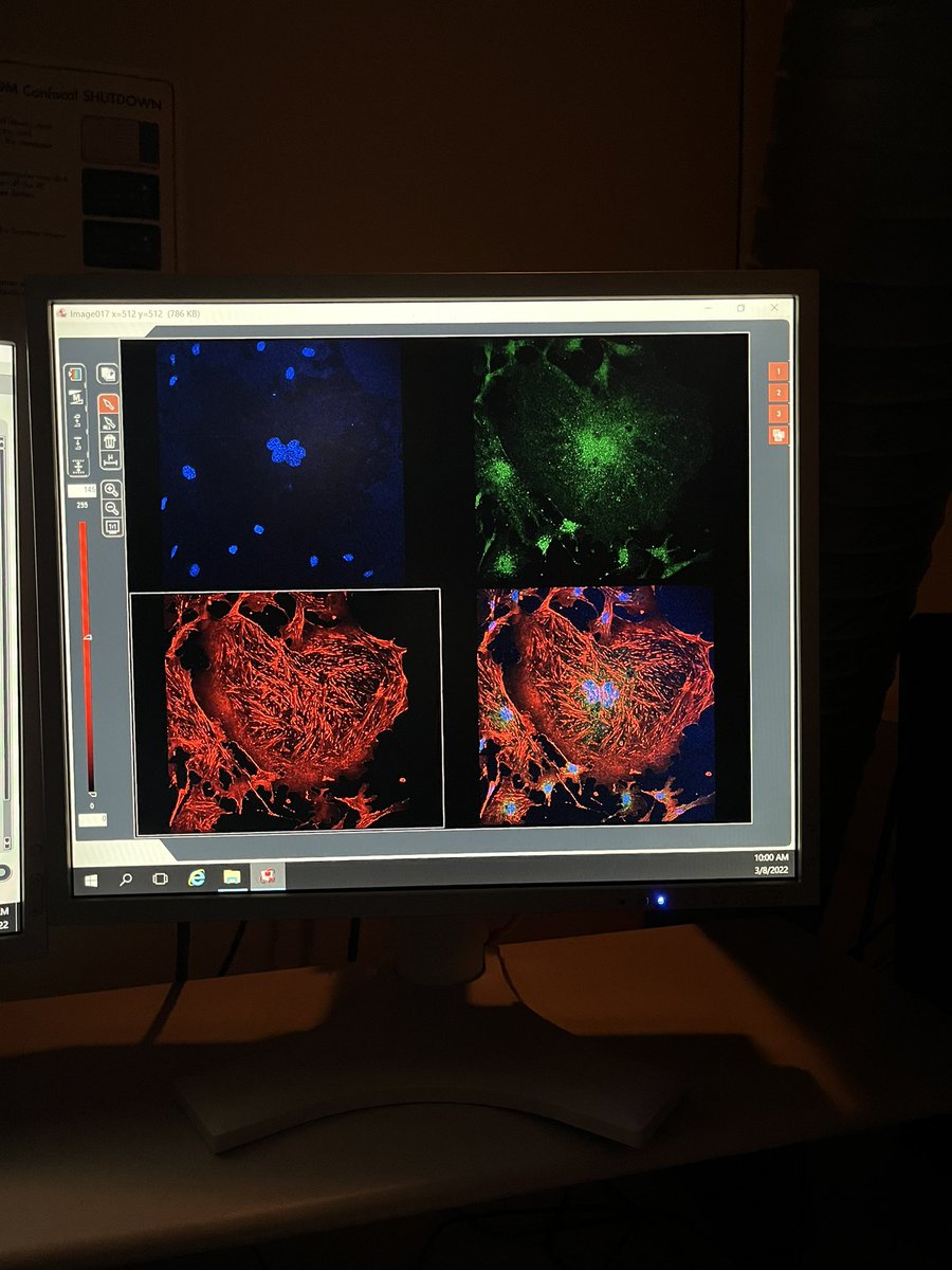 More podocyte love! Finding beauty everywhere ❤️‍🔥🔬 #Nephrology #NephTwitter #Womeninnephrology #MedTwitter