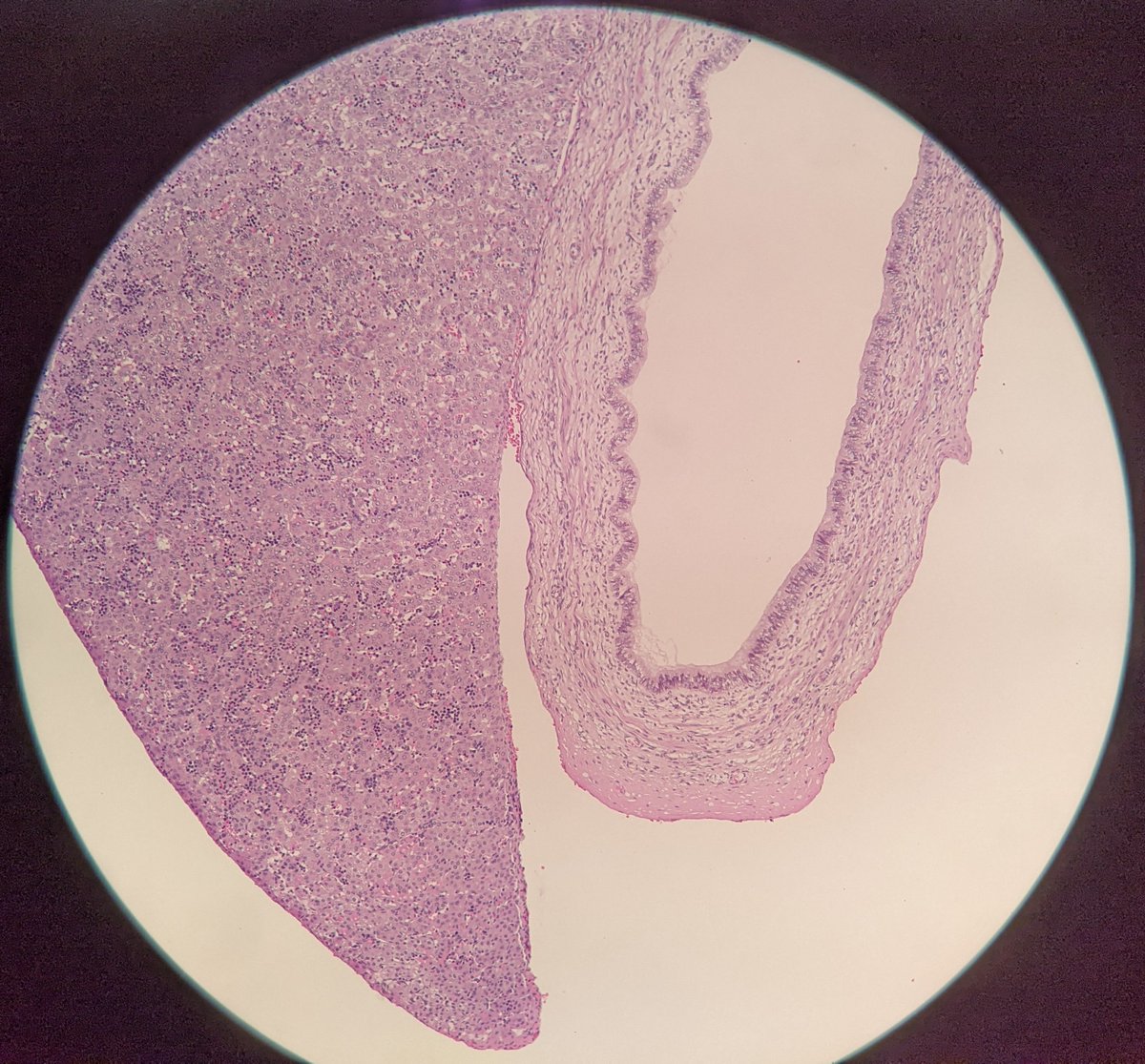 vicvise2's tweet photo. [No emoji found] Young organ #FetalPath #BeautyInTheBenign 🫂 https://t.co/yy9bGPv8Vu