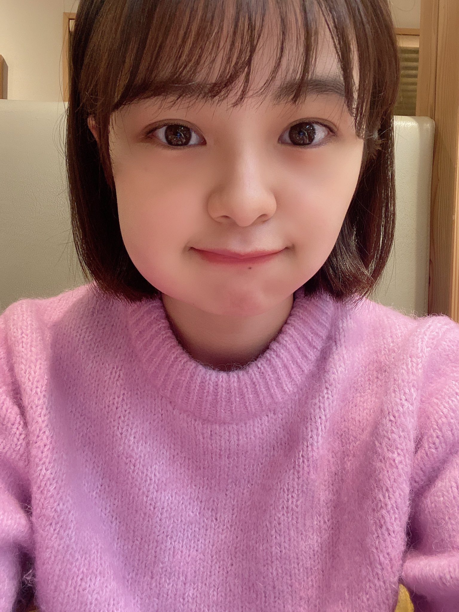 本間日陽 親知らず3本抜歯2日後 すっぴんですが悪しからず T Co Lpd2vwvqix Twitter