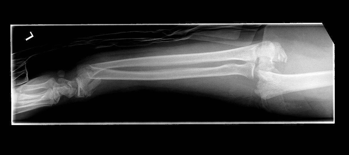 traumaticum's tweet photo. A horse is just a big hairy motocross bike. 

Change my mind.

#orthotwitter #trampolinegrinch #pedipod
@Pranai_B @Davembmd https://t.co/sRpLBOpLb7
