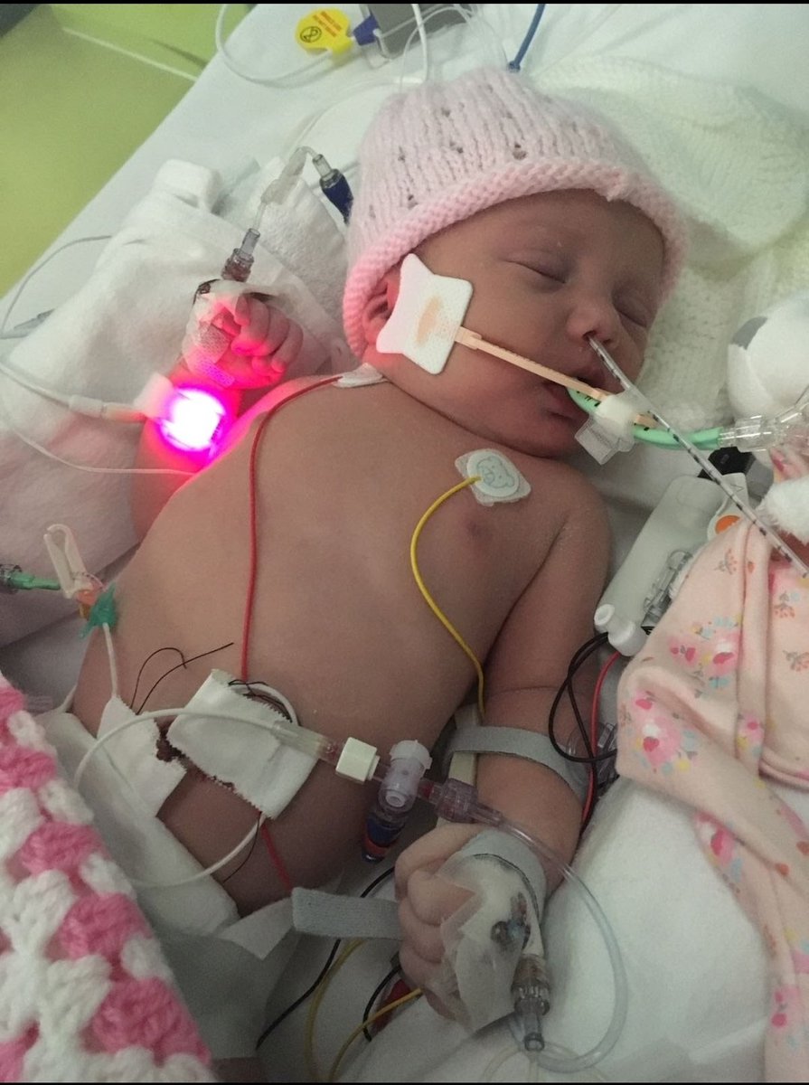 splugen31's tweet photo. Happy Birthday to our beautiful daughter Florence, can't believe you're 4! You've made us so proud! So much thanks as always to @HeartCentreAld1 @team_1c @DrRamanaCardiac @TheBHF #forevergrateful ❤❤❤ https://t.co/VD1tx3qHVn