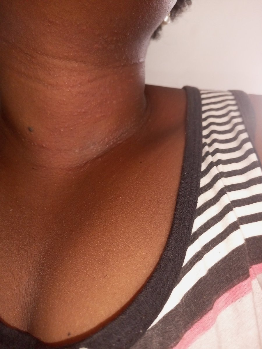 omidan_agbeke's tweet photo. Iffa die na una kill me @Ibedc_ng and @seyimakinde bcos what the fuck is this heat and you people decide to punish us with light. I literally choked last night, I'm really tired of the lawlessness of this country.
#Fixourlight #wedeserveagoodlight
#righttosocialamenities https://t.co/Dgs10xNSkT