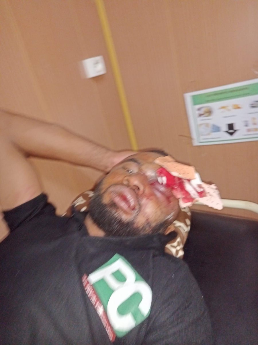 mbeatowe's tweet photo. Yaoundé,Tentative d’assassinat:Le journaliste Paul Chouta à été enlevé hier nuit au quartier Damas par des hommes véhiculés qui l'ont entraîné dans une localité périphérique située sur l'autoroute Nsimalen-Yaoundé. Il a été copieusement tabassé et retrouvé tout nu et ensanglanté https://t.co/PZcLFZ2DAS