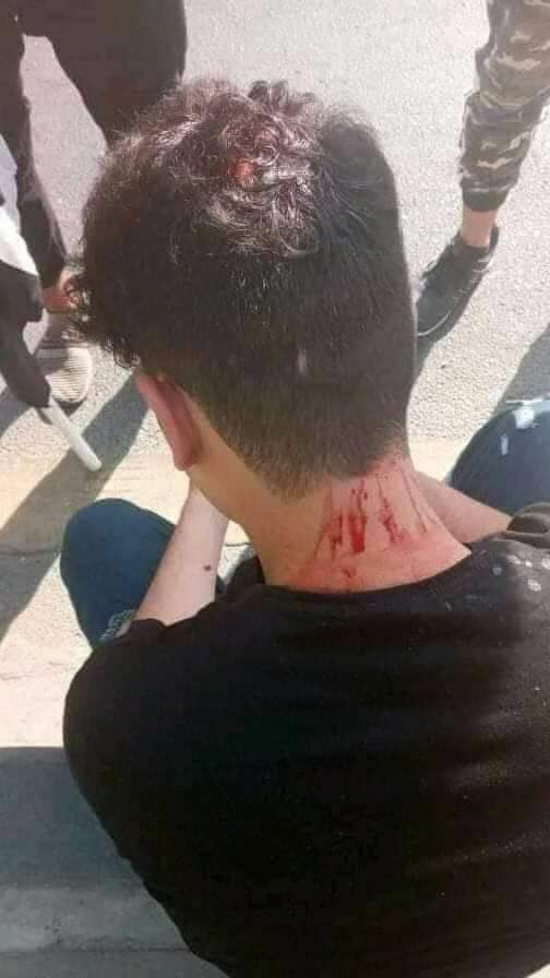 الاعتداء على حامل شهادة عليا بطريقة وحشية مر مرور الكرام…
هل من منصف ينصف قضيتهم ام هؤلاء ليسوا اخوتكم ؟