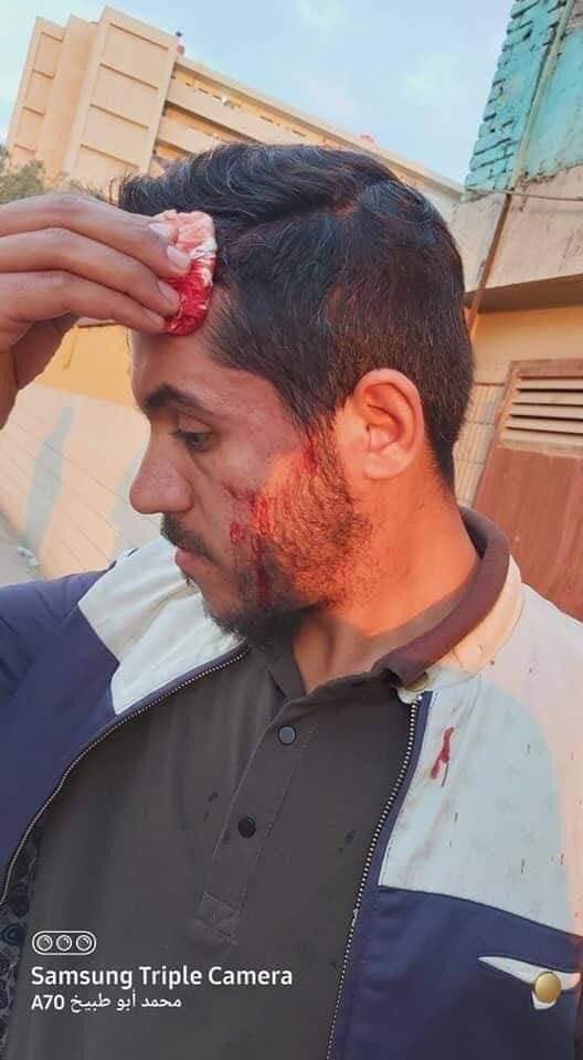 h_raawa76's tweet photo. الاعتداء على حامل شهادة عليا بطريقة وحشية مر مرور الكرام…
هل من منصف ينصف قضيتهم ام هؤلاء ليسوا اخوتكم ؟ https://t.co/7dhHpzDhvn