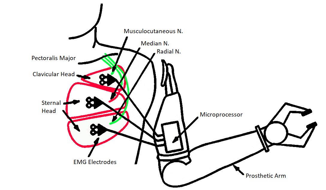 20/ On control systems, a real-world example for Open Bionics is used to show the excellent control systems that are currently used to control advanced prosthetics along with new electromyography systems which are also suitable...