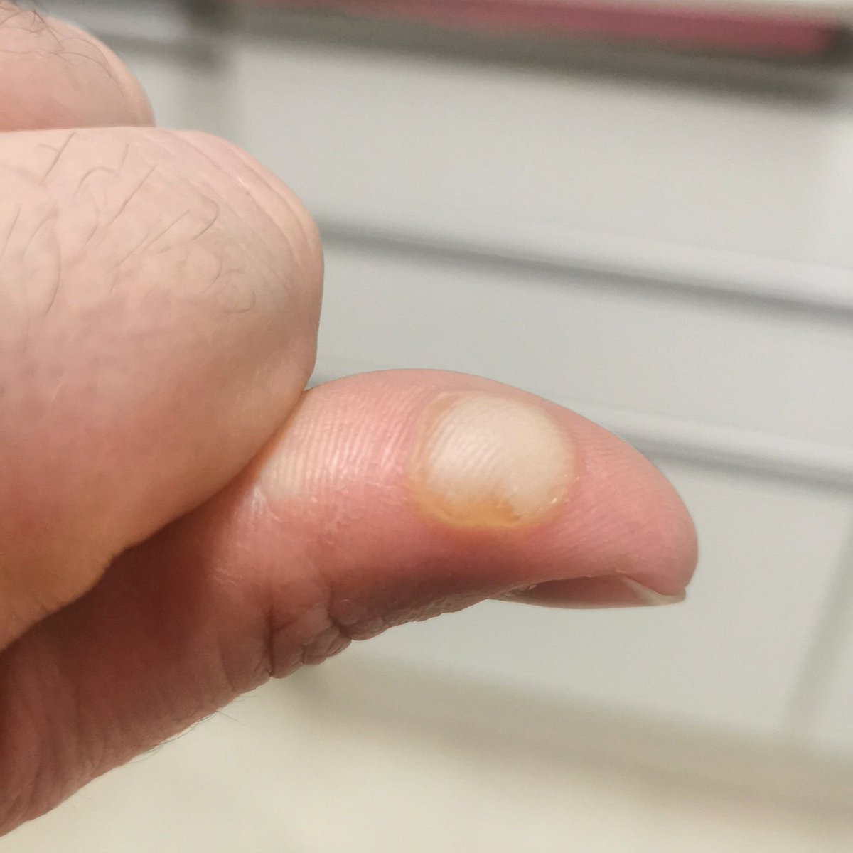 smokeybroad's tweet photo. DISGUSTING customer services @bmstores Raise inferior quality as a concern to customer services. Point out the "gesture of goodwill" is an insult for 5 days of pain, time and inconvenience. Their tone changes and they become quite obstructive. #poorcustomerservices #poorservice https://t.co/Y2QF9bHwtx
