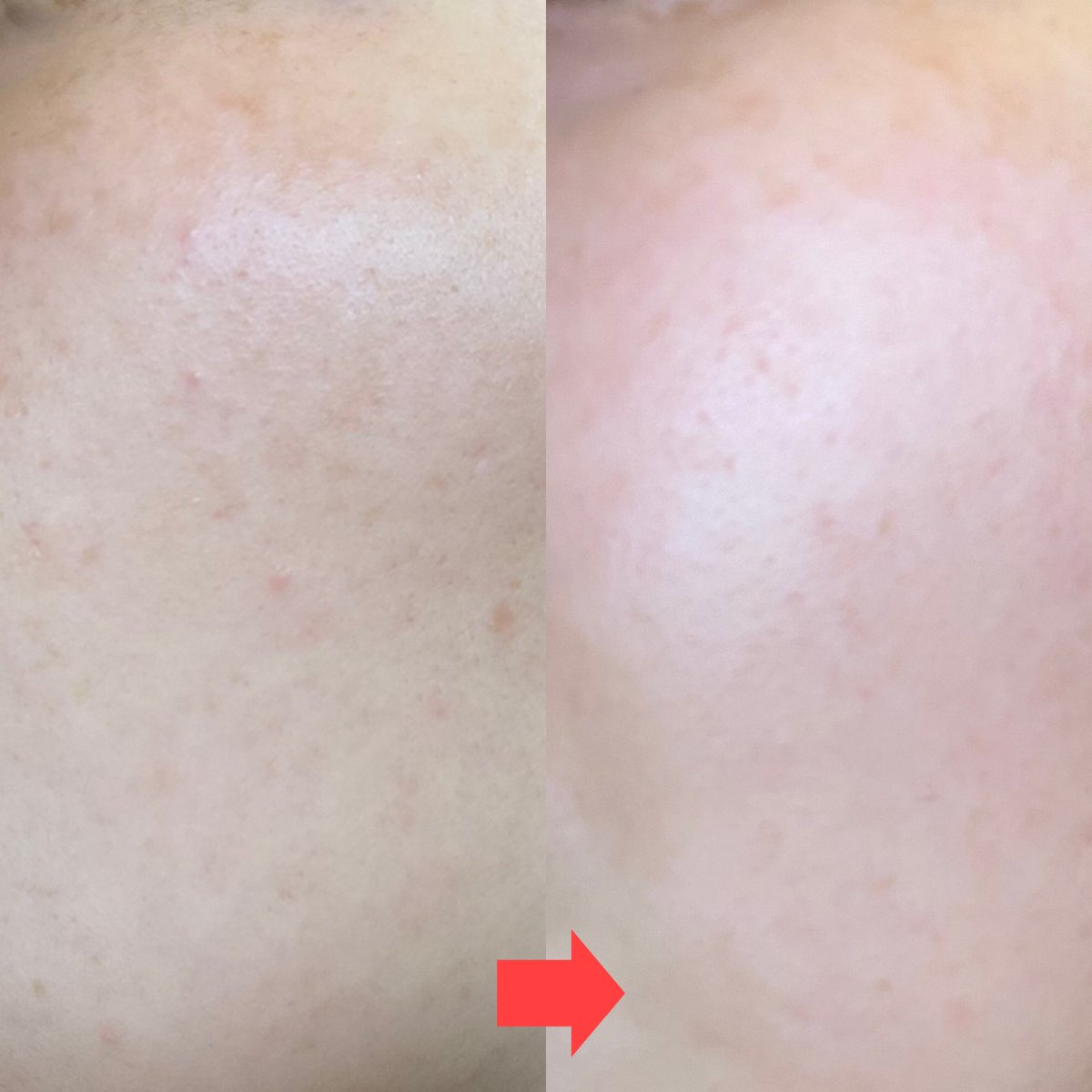 4年保証』 即日発送 シロナルエッセンス 新品 箱入り 30ml i9tmg.com.br