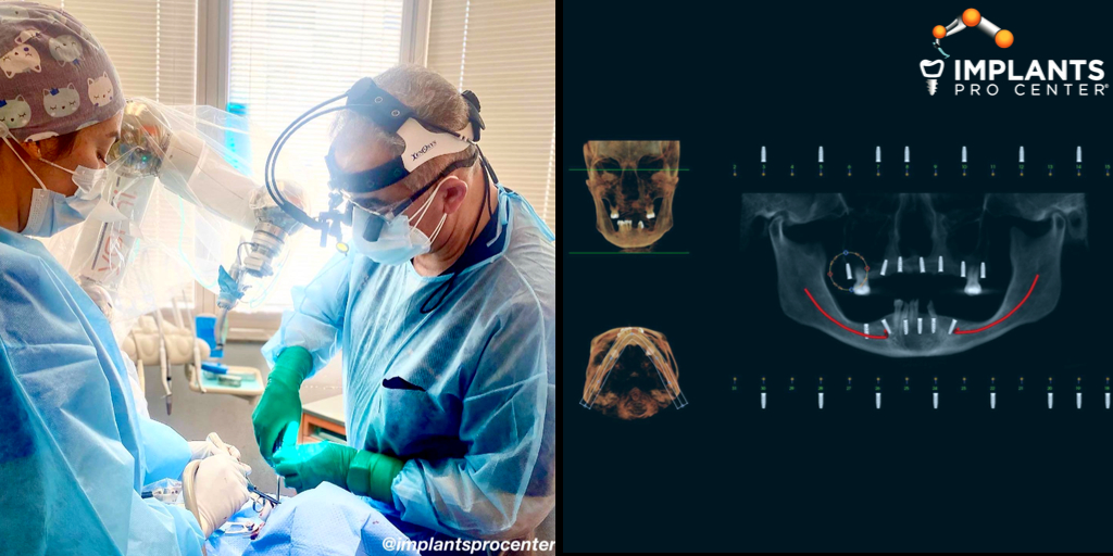 Implantspro's tweet photo. Happy Hump Day!!! 
Beautiful day for a double full-arch case. Changing lives one smile at a time.
If you’re ready for your smile update, contact us at 415.481.0778.
https://t.co/btJjZPbOqK
.
#ImplantsProCenter #DentalImplants #TreatmentPlan #FreeSmile #RoboticSurgery #DentalVisit https://t.co/AnTz2udb7G