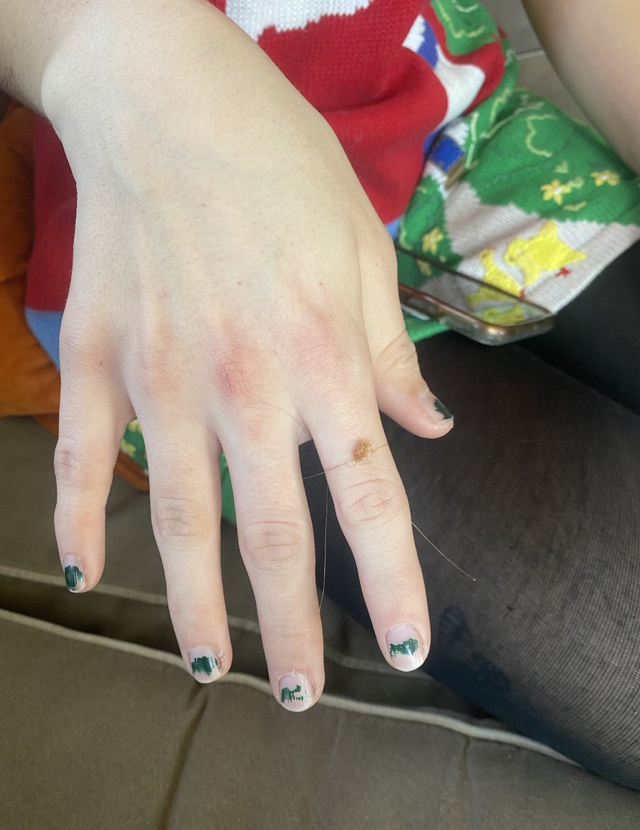 RaaccheelllM's tweet photo. @zoe_roden proposed and i said yes (my hair i made this ring but she tied the knot) https://t.co/czq1IHYnjg