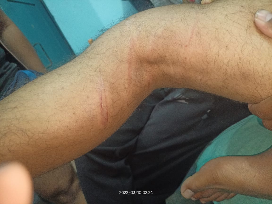 mee_satyamurthy's tweet photo. Late night on 09/03/2022 4 policemen in uniform, drunk, allegedly entered Boys hostel of Govt. Veterinary college Shirwal Dist. Satara and thrashed students ruthlessly with personal intentions. Today, higher police officials stated it as a 'mistake' @Dwalsepatil @NitinNandgaonk3 https://t.co/pxjtODQorE