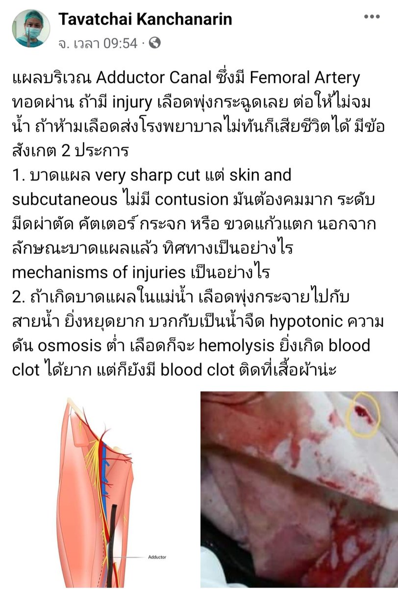 LGlindaa's tweet photo. คุณหมอท่านนี้วิเคราะห์บาดแผล ได้น่าสนใจมาก #แตงโมต้องไม่ตายฟรี https://t.co/nmncoUrkYb