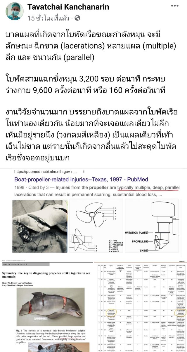LGlindaa's tweet photo. คุณหมอท่านนี้วิเคราะห์บาดแผล ได้น่าสนใจมาก #แตงโมต้องไม่ตายฟรี https://t.co/nmncoUrkYb