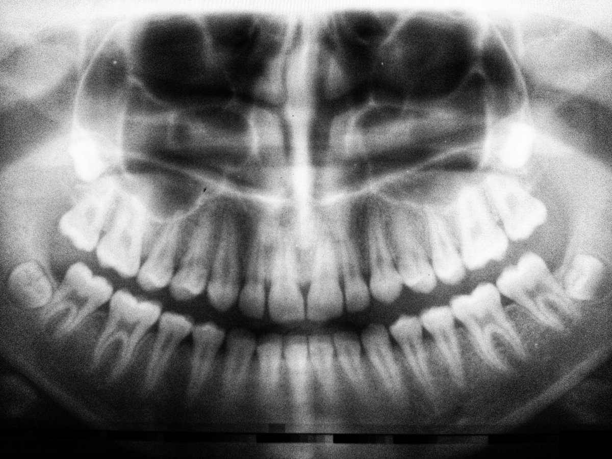 VITA_Network's tweet photo. In our latest blog!
 
#connect with Dr Linzi Maybin, the founder of @HappyTeethReach and VITA lead dentist! As we discover her story and motivation for helping young people and those affected by modern slavery human trafficking.
 
Find it here ⬇️
https://t.co/9j1HRXxtrk
#dentist https://t.co/WqefFsAuJy