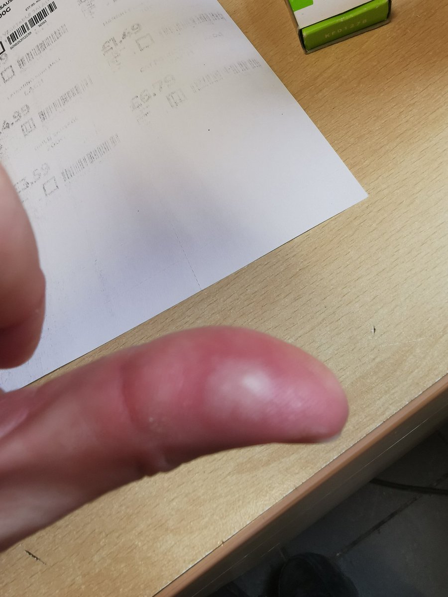 smokeybroad's tweet photo. Perhaps @Simon_Arora is a better point of contact to get a better response to my ongoing customer complaint with @bmstores regarding my painful burn due to their inferior quailty oven gloves #poorservice #dangerous #notinterested #tradingstandards https://t.co/C1QqfXizhc