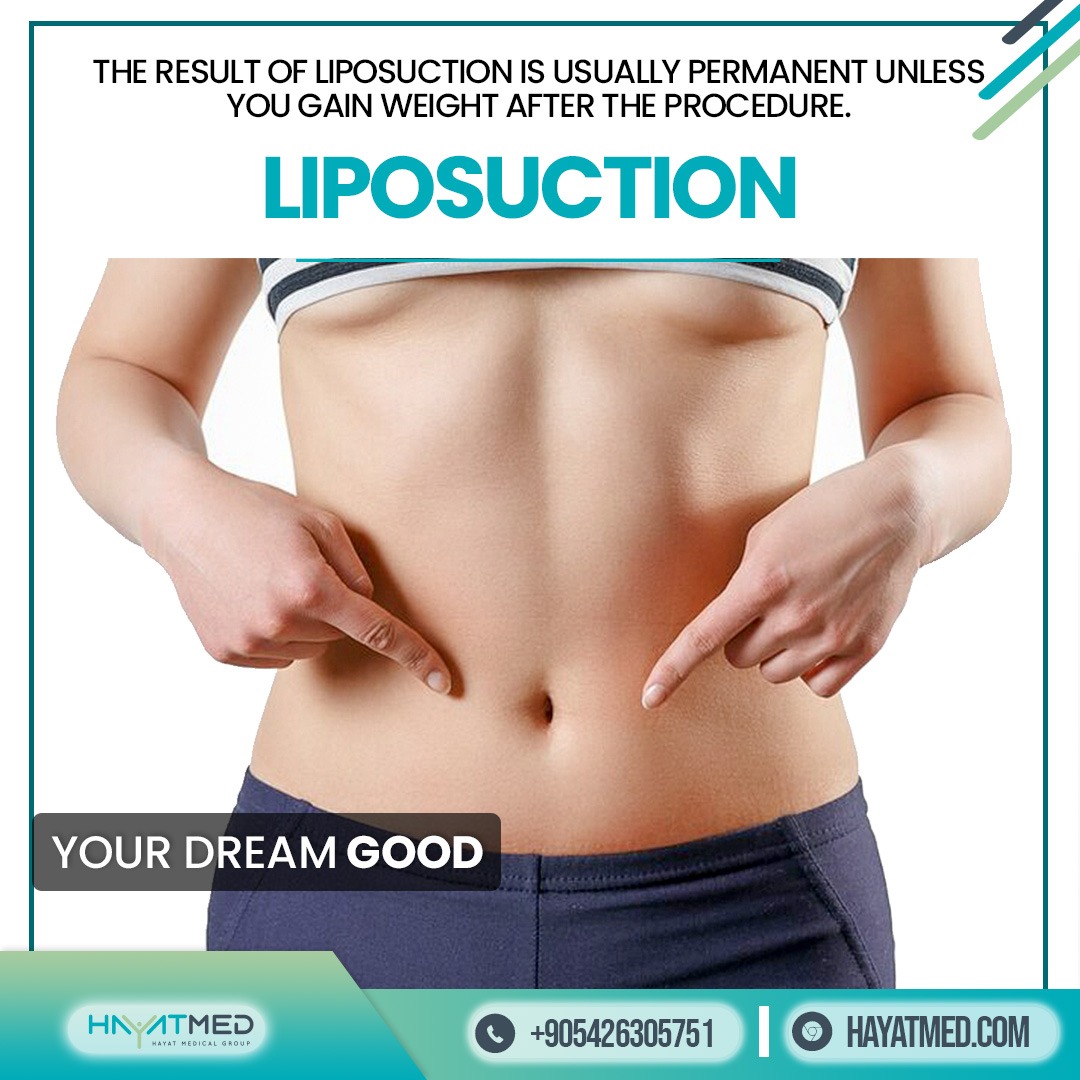 Hayatmedclinic's tweet photo. Change Your Life With #Hayatmedclinic 

#liposuction in #Turkey with the best doctors at affordable prices 

#liposuctionturkey #liposuctionbeforeandafter #liposculpture #liposuctionistanbul #lipoplastia #vaserliposuction #vaserlipo #hdliposuction  #istanbul #london #beauty #UK https://t.co/3i2i1KweoQ