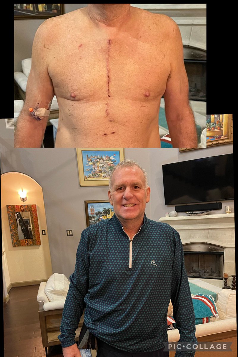 AmandaOnFOX7's tweet photo. After more than two weeks in the hospital, Mike made it home healthy and is on the mend. He (we) went through Hell and back w/battle scars as proof. To the ENTIRE staff @bswhealth at Baylor Scott & White: THANK YOU! You guys are doing God’s work #OpenHeartSurgery #EmbolicStroke https://t.co/AA1y37h6wH