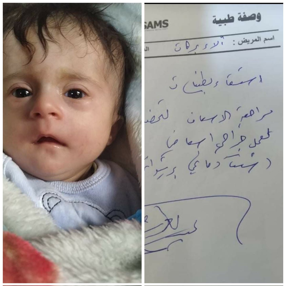 dulama_1's tweet photo. بنتي آلاء يا أخي أجت من شهرين. وكل ساعتين تغيب عن الوعي وتعرق وتراجع والله متنا عليها 
أخدناها عالدكتور قال في سائل براسها وبدها عملية وقالولي حق الجهاز 600$ وأنا مامعي منهم ليرة عايش بخيمة يا أخي.  (والد آلاء ) 
بهمتكن منقدر نأمن المبلغ ونعمل الجراحة لآلاء بأسرع وقت ممكن
همتكن https://t.co/3nTKwCC8Qd