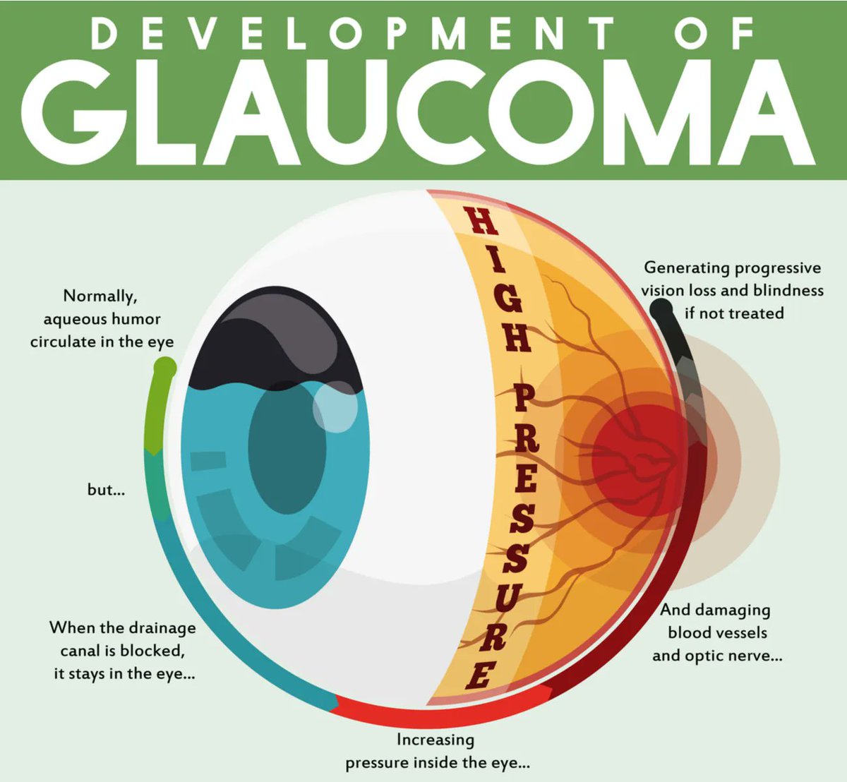 BagotOpticians's tweet photo. It’s #WorldGlaucomaWeek. 

Glaucoma symptoms can include headaches, blurred vision or blind spots in your vision – but it's mostly asymptomatic in its early stages, so regular eye exams with OCT scans are vital.

Book your eye exam now: https://t.co/vWO8iHfYTf https://t.co/hiBDnVC2eu