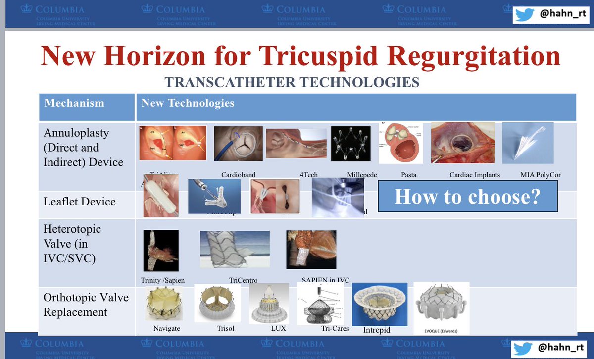 Finally got some time to post super educational slides from @hahn_rt’s talk on structural imaging updates at #LLUHeart 
💡dobutamine stress flow rate for AS severity  #Echofirst 
💡use of #whyCMR and GLS for asymptomatic severe AS 
💡mechanism of MR
💡new horizon for severeTR