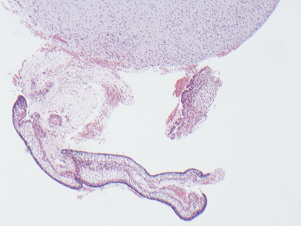 Oral Path Opinion tweet media