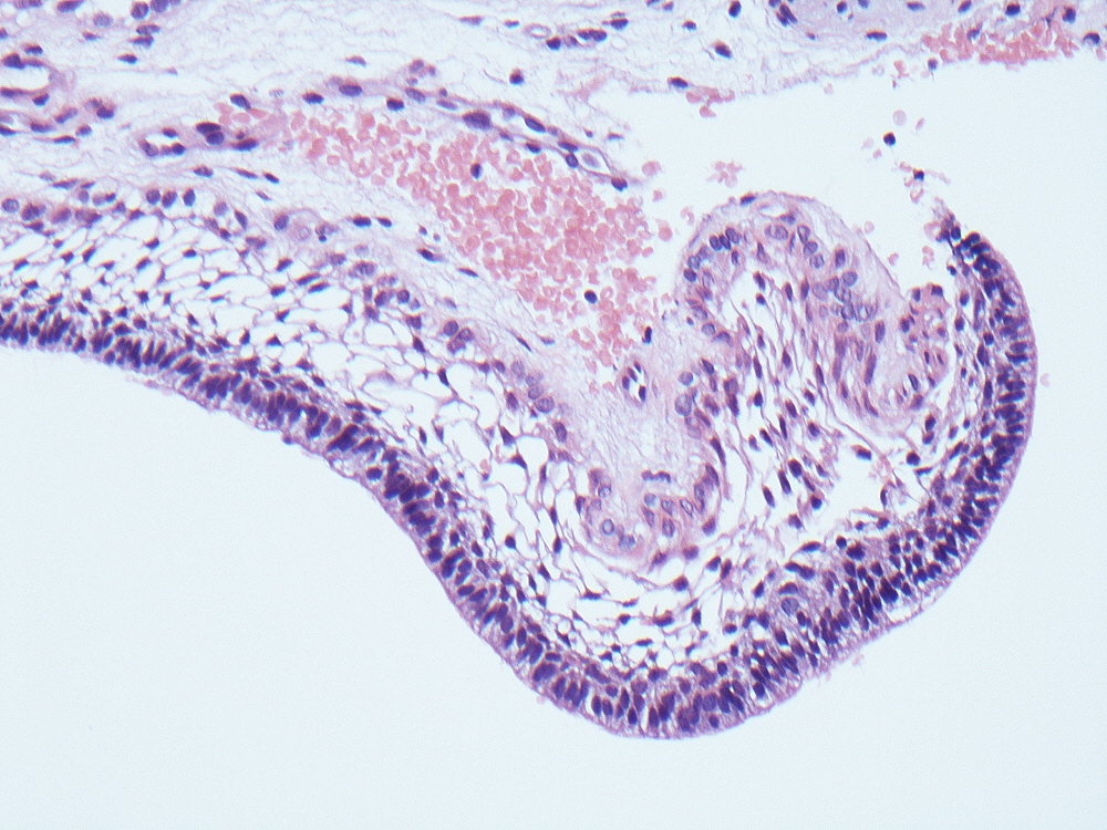 Oral Path Opinion tweet media