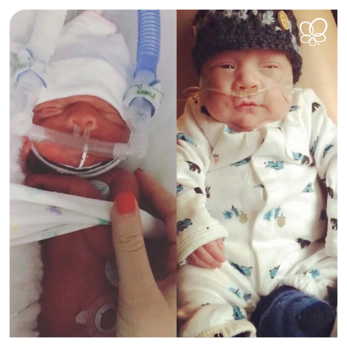 prolacta's tweet photo. #26weeker, Pierce, was born weighing just 2 lbs 4 oz (1088 g). Mom, Annelise, says he was a rock star when feeding. With mom’s breast milk and our fortifiers, Pierce went home from the #NICU after 59 days. 
https://t.co/D65MnNaerC https://t.co/Qyvlwokd74