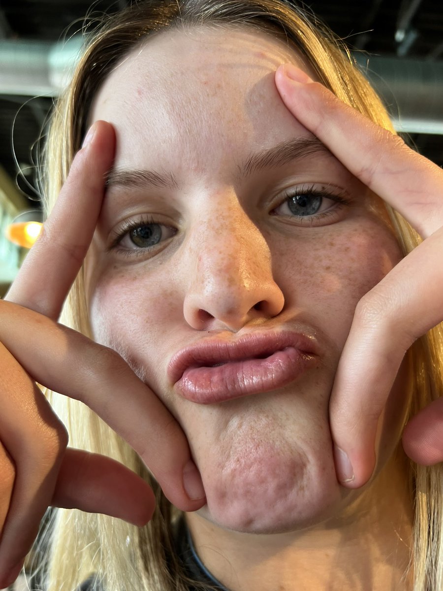 coachjesspauls's tweet photo. HAPPY BIRTHDAY @sadiebeck2024 #shinangle #proudcoach https://t.co/gMtsh9lcF1