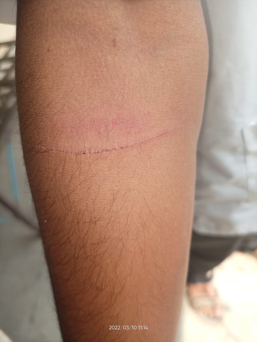 Vaibhav00747929's tweet photo. #SaveVetStudent
अतिशय निंदनीय प्रकार काल क्रांतिसिंह नाना पाटील पशुवैद्यकीय महाविद्यालय शिरवळ येथील सुभानमंगळ वसतिगृहामध्ये पोलिसांकडून दारू पिऊन मुलांना  काहीही कारण नसताना रात्री जबर मारहाण केली. 
#निलंबन_झालेच_पाहिजे @PMOIndia
@drsanjeevbalyan @icarindia @Dept_of_AHD https://t.co/hKOvjQqCCE