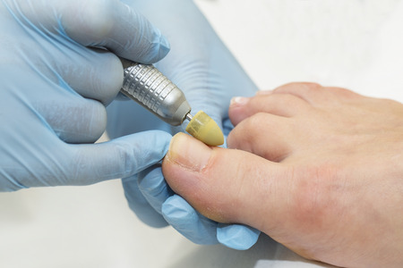ChicagoFootCare's tweet photo. Now is the perfect time for treating #toenailfungus Visit #lasercenter to treat #onychomycosis https://t.co/ccVVcozLuw #bestpodiatrist #podiatristnearme https://t.co/gvLMWDGx7F