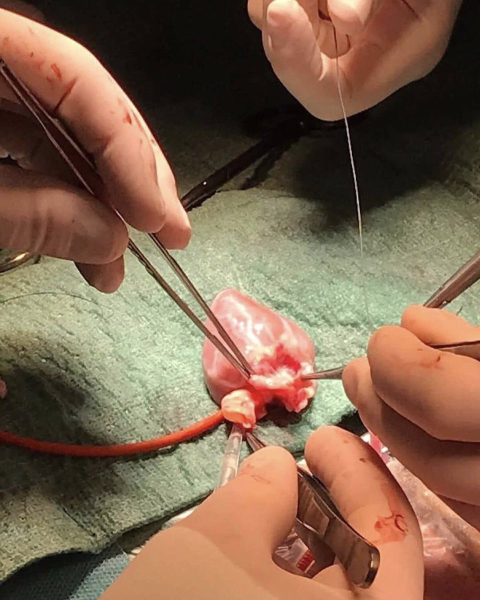 Kardiyoloji_'s tweet photo. Pandemi bitti doktorlar giderse gitsin dersiniz ama doktorlar küçüçük bir meleğe kalp nakli yaparak ona yeni bir hayat sunmaya devam ederler 👼🫀 https://t.co/fiFiH6xn2e