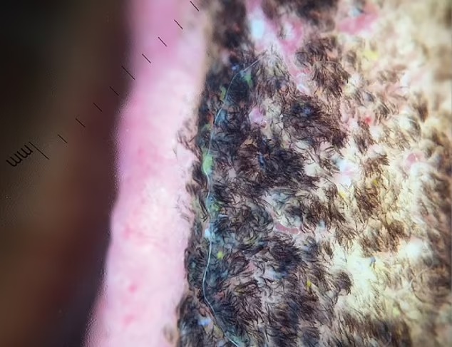 DailyMail's tweet photo. Man's tongue turns BLACK and 'HAIRY' because of his diet https://t.co/xGVN03GCsh https://t.co/z65pSzbVS1