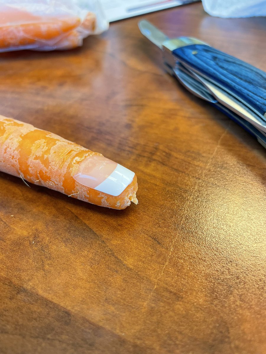 Ben Ihms, DO (@benihms) on Twitter photo It’s exactly what it looks like - a carrot with a fake nail gorilla glued to the end of it. 6 carrots and 12 fingerling potatoes later, our toenail removal workshop was a success! #MedTwitter #residency <a href="/MVMCFamilyMed/">Mountain Vista Family Medicine</a> It’s exactly what it looks like - a carrot with a fake nail gorilla glued to the end of it. 6 carrots and 12 fingerling potatoes later, our toenail removal workshop was a success! #MedTwitter #residency <a href="/MVMCFamilyMed/">Mountain Vista Family Medicine</a>