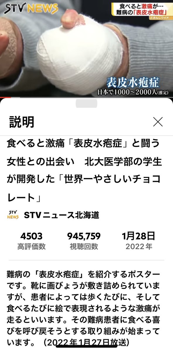 kayko_mmt's tweet photo. 3月11日、再生回数94万5,000回超えました!マジ、100万回も夢じゃない!11���回超えて驚いていた2月がまるで夢のようじゃないか。これほどに表皮水疱症を知っていただけたと思うと患者会活動の励みに繋がる。生きる励みに繋がる。そう思うと感謝しかない。
#debrajapan
https://t.co/v9mtdLIWvJ https://t.co/wxefPDSCip