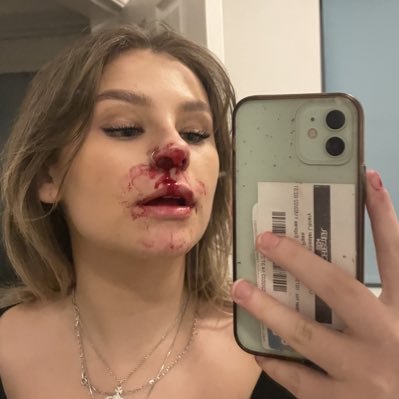 molly phillips tweet media