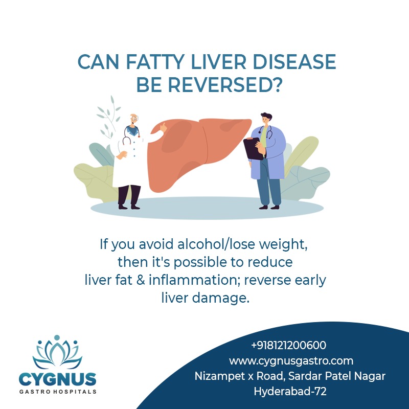 Did you know?
You can reverse liver damage by avoiding alcohol/losing weight as it helps in reducing liver fat & inflammation. 
Adopt a healthy lifestyle to avoid/reduce #fattyliver. 

#fattyliverreversed #fattyliverdisease #preventfattyliver #CygnusGastroHospitals