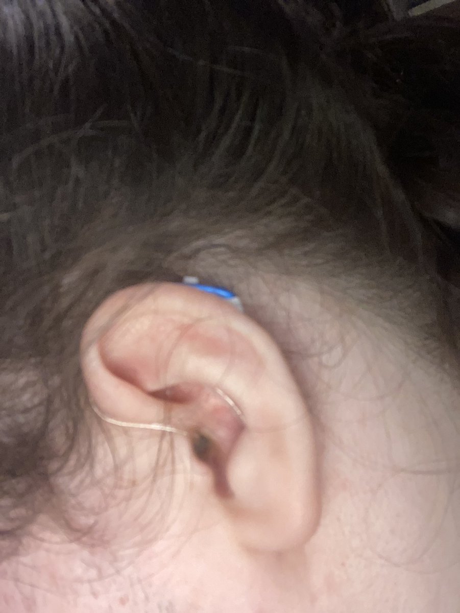 laura case ☘️ tweet media