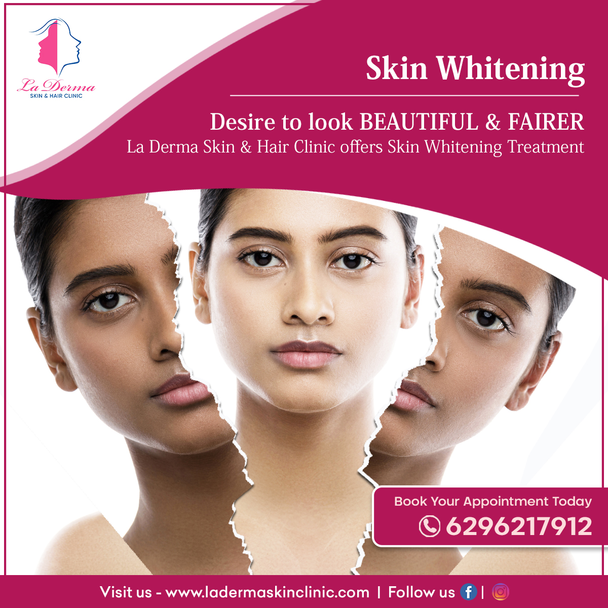 glutathione skin lightening treatment laser hair removal | acne scar treatment
