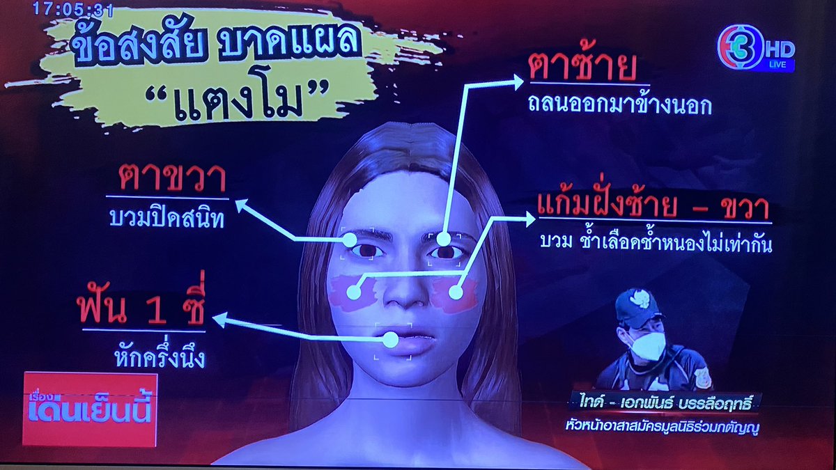 มีบุคคลใกล้ชิดแตงโมติดต่อเรื่องเด่นเย็นนี้ เล่าว่าแตงโมไปใช้วิธีการทำฟันพอร์ชเลนวีเนียร์ มันจะไม่แตก ไม่หักง่าย ถ้าจะหัก ต้องผ่านวัตถุที่แข็งมากๆ ลำพังตกน้ำไม่มีทางที่จะทำให้ฟันหักและมองว่าการที่ฟันหัก ทำไมตำรวจไม่ชี้แจง #แตงโมต้องได้รับความยุติธรรม