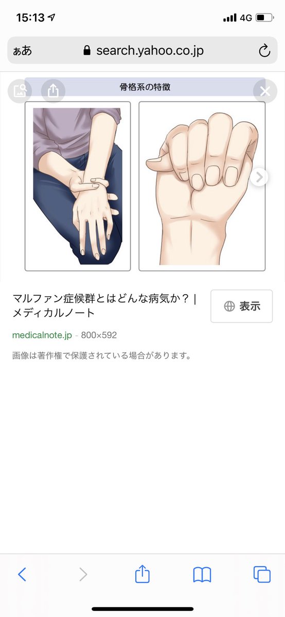 四柱推命鑑定士 飯島寛子 今回 ブログで米津玄師さんにしたのは たまたまマルファン 症候群っていう病気の特徴に私が当てはまっていて調べたら米津玄師さんの名前が出てきたから 勝手に占ってみたシリーズ T Co 四柱推命鑑定士 飯島寛子 今回 ブログで米津玄師さんにしたのは たまたまマルファン 症候群っていう病気の特徴に私が当てはまっていて調べたら米津玄師さんの名前が出てきたから 勝手に占ってみたシリーズ T Co