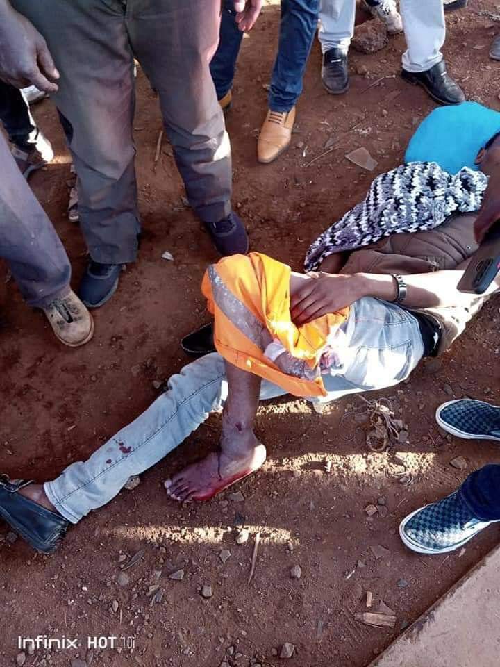 MikeSonko's tweet image. JUST FOR INFORMATION. This is Hezron Mwenda, the Motor bike rider who was hit by the lady who was harrased. Hezron is not a boda boda guy, but an employee  of a laundry company that does VIP.