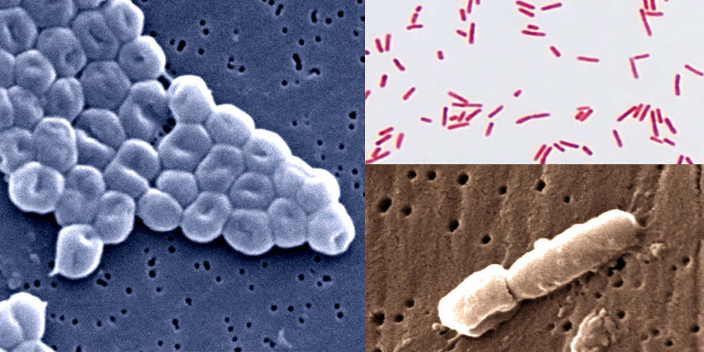 Telum_Tx's tweet photo. According to @WHO, it is critical to develop new compounds against:
 
🦠Acinetobacter baumannii
🦠Pseudomonas aeruginosa
🦠Enterobacteriaceae
 
Have a look at our pipeline to discover our solutions 👉https://t.co/rLLz1LUzB8 https://t.co/6uUbfl8V9P